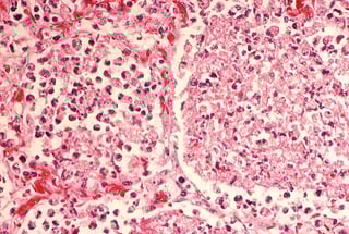 legionella bacteria .jpg